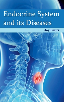 Endocrine System and Its Diseases - Foster, Joy (Editor)