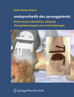 Endoprothetik Des Sprunggelenks: Historischer Uberblick, Aktuelle Therapiekonzepte Und Entwicklungen - Hintermann, Beat