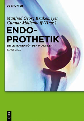 Endoprothetik - Krukemeyer, Manfred Georg (Editor), and Mllenhoff, Gunnar (Editor)