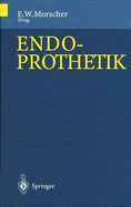 Endoprothetik