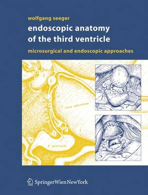 Endoscopic Anatomy of the Third Ventricle: Microsurgical and Endoscopic Approaches - Seeger, Wolfgang