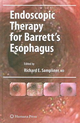 Endoscopic Therapy for Barrett's Esophagus - Sampliner, Richard E (Editor)