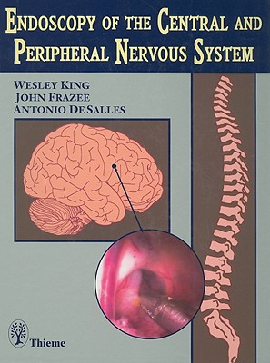 Endoscopy of the Central and Peripheral Nervous System - King, Wesley L, and Frazee, John G, and Desalles, Antonio A F