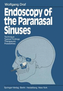 Endoscopy of the Paranasal Sinuses: Technique . Typical Findings Therapeutic Possibilities - Draf, Wolfgang