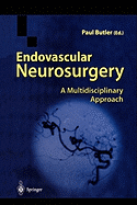 Endovascular Neurosurgery: A Multidisciplinary Approach