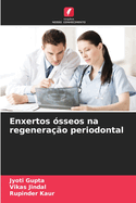 Enxertos sseos na regenerao periodontal