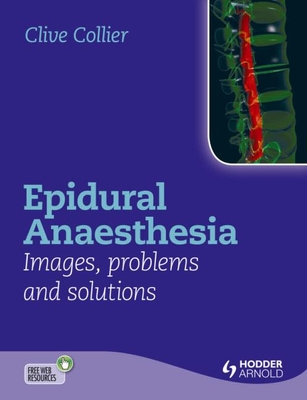 Epidural Anaesthesia: Images, Problems and Solutions - Collier, Clive