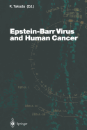 Epstein-Barr Virus and Human Cancer