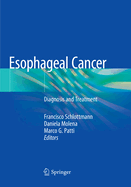 Esophageal Cancer: Diagnosis and Treatment