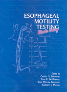 Esophageal Motility Testing Made Easy