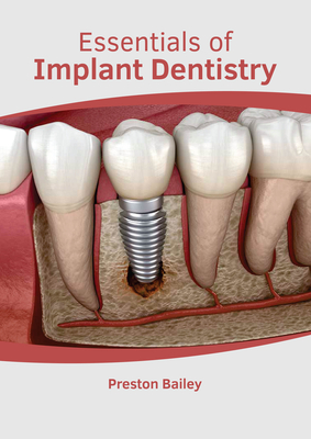 Essentials of Implant Dentistry - Bailey, Preston (Editor)