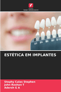 Est?tica Em Implantes
