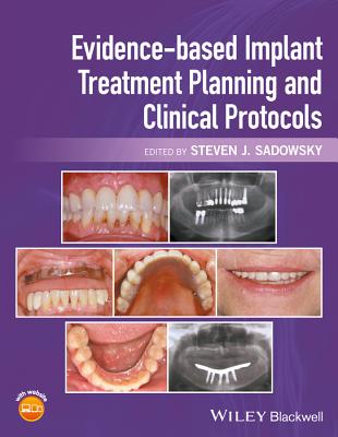 Evidence-based Implant Treatment Planning and Clinical Protocols - Sadowsky, Steven J. (Editor)