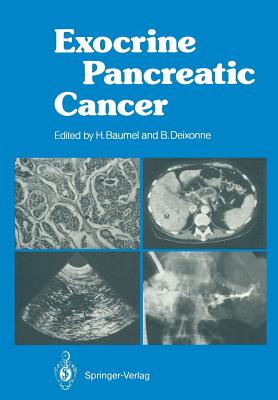 Exocrine Pancreatic Cancer - Baumel, Hughes (Editor), and Sarles, H (Foreword by), and Deixonne, Bernard (Editor)