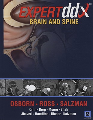 EXPERTddx: Brain and Spine: Published by Amirsys - Osborn, Anne G., MD, and Ross, Jeff, and Crim, Julia