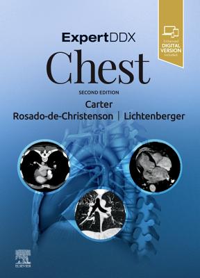 ExpertDDx: Chest - Carter, Brett W., MD, and Rosado-de-Christenson, Melissa L., MD, FACR, and Lichtenberger III, John P., Maj., MD