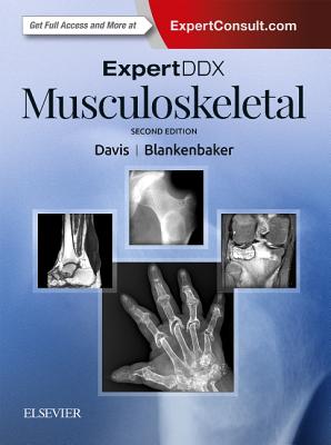 Expertddx: Musculoskeletal - Davis, Kirkland W, MD, Facr, and Blankenbaker, Donna G, MD, Facr