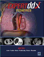 EXPERTddx: Pediatrics: Published by Amirsys (R)