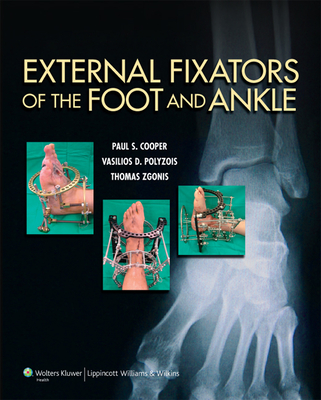 External Fixators of the Foot and Ankle - Cooper, Paul, Dr., and Polyzois, Vasilios, Dr., and Zgonis, Thomas, Dpm