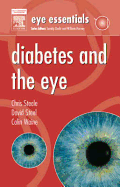 Eye Essentials: Diabetes and the Eye