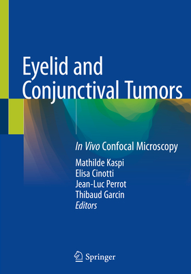 Eyelid and Conjunctival Tumors: In Vivo Confocal Microscopy - Kaspi, Mathilde (Editor), and Cinotti, Elisa (Editor), and Perrot, Jean-Luc (Editor)