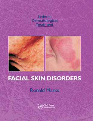 Facial Skin Disorders - Marks, Ronald