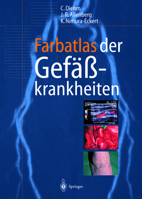 Farbatlas Der Gefaakrankheiten - Diehm, Curt, and Allenberg, J -R, and Nimura-Eckert, Keiko