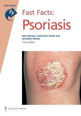 Fast Facts: Psoriasis - Barker, Jonathan, and Menter, Alan, and Smith, Catherine