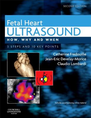 Fetal Heart Ultrasound: How, Why and When - Fredouille, Catherine, and Develay-Morice, Jean-Eric, MD, and Lombardi, Claudio