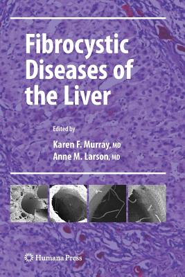 Fibrocystic Diseases of the Liver - Murray, Karen F. (Editor), and Larson, Anne M. (Editor)