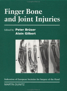 Finger Bone and Joint Injuries - Bruser, Peter, and Gilbert, Alain, MD