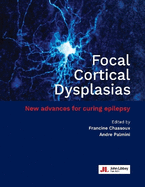 Focal Cortical Dysplasias: New advances for curing epilepsy