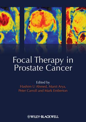 Focal Therapy in Prostate Cancer - Ahmed, Hashim Uddin (Editor), and Arya, Manit (Editor), and Carroll, Peter R. (Editor)