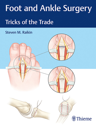 Foot and Ankle Surgery: Tricks of the Trade - Raikin, Steven M