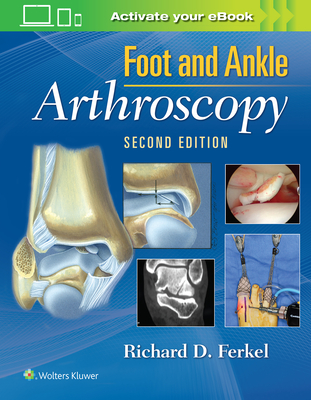 Foot & Ankle Arthroscopy - Ferkel, Richard D, MD