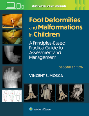 Foot Deformities and Malformations in Children: A Principles-Based, Practical Guide to Assessment and Management: Print + eBook with Multimedia - Mosca, Vincent