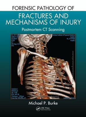 Forensic Pathology of Fractures and Mechanisms of Injury: Postmortem CT Scanning - Burke, Michael P