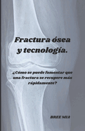 Fractura sea y tecnologa.: Cmo se puede fomentar que una fractura se recupere ms rpidamente?