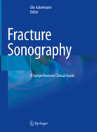 Fracture Sonography: A Comprehensive Clinical Guide