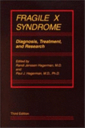 Fragile X Syndrome: Diagnosis, Treatment, and Research