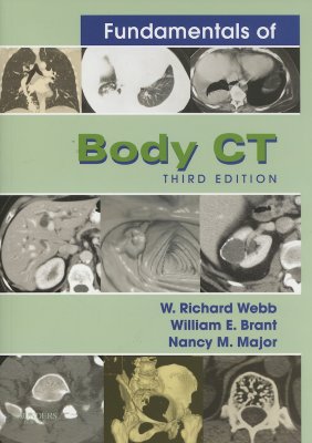 Fundamentals of Body CT - Webb, W Richard, M.D., and Brant, Wiliam E, MD, Facr, and Major, Nancy M, MD