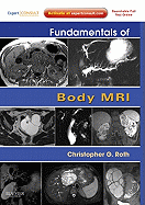 Fundamentals of Body MRI: Expert Consult- Online and Print