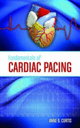 Fundamentals of Cardiac Pacing