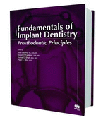 Fundamentals of Implant Dentistry: Prosthodontic Principles: 1