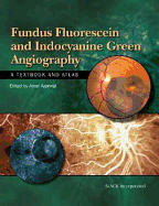 Fundus Fluorescein and Indocyanine Green Angiography: A Textbook and Atlas