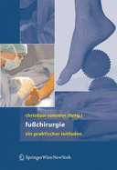 FussChirurgie: Ein Praktischer Leitfaden