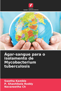 ?gar-sangue para o isolamento de Mycobacterium tuberculosis