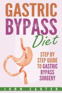 Gastric Bypass Diet: Step by Step Guide to Gastric Bypass Surgery