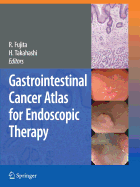 Gastrointestinal Cancer Atlas for Endoscopic Therapy