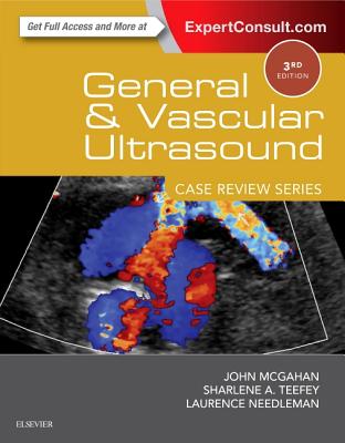 General and Vascular Ultrasound: Case Review - McGahan, John P, MD, and Teefey, Sharlene A, MD, and Needleman, Laurence, MD